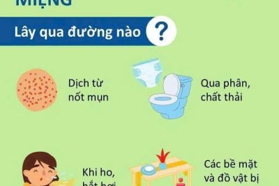 ⚠️ CẢNH GIÁC VỚI BỆNH TAY CHÂN MIỆNG! ⚠️  Bệnh Tay Chân Miệng đang vào mùa. Đừng chủ quan vì bệnh lây lan rất nhanh qua tiếp xúc và đường tiêu hóa. Hiện bệnh CHƯA CÓ VẮC-XIN phòng ngừa. Hãy cùng Trạm Y tế phường “bỏ túi” ngay những kiến thức quan trọng này nhé:  🔍 DẤU HIỆU NHẬN BIẾT: Trẻ sốt (>37.5°C), đau họng, biếng ăn. Loét miệng, gây đau rát khiến trẻ quấy khóc, bỏ ăn. Nổi nốt phỏng nước ở các vị trí đặc trưng: Lòng bàn tay, lòng bàn chân, đầu gối, vùng mông.  🛡️ PHÒNG BỆNH HƠN CHỮA BỆNH: ✅ Rửa tay thường xuyên bằng xà phòng (cả người chăm sóc và trẻ). ✅ Khử khuẩn đồ chơi, bề mặt bàn ghế, sàn nhà. ✅ Che miệng khi ho/hắt hơi; không dùng chung đồ cá nhân. ✅ Nếu trẻ có dấu hiệu bệnh, hãy cho trẻ nghỉ học và ở nhà theo dõi.  💊 ĐIỀU TRỊ ĐÚNG CÁCH: ❌ KHÔNG tự ý dùng kháng sinh (vì bệnh do virus gây ra). ✅ Cho trẻ uống nhiều nước, ăn đồ mềm/nguội. ✅ Theo dõi sát sao, đưa trẻ đến cơ sở y tế ngay nếu triệu chứng không giảm sau 10 ngày hoặc có dấu hiệu chuyển nặng.  📸 Xem chi tiết hướng dẫn từ WHO trong các hình ảnh dưới đây!